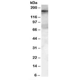 Western blot testing of HeLa lysate with GEF5 antibody at 0.1ug/ml. Predicted molecular weight: ~177 kDa.