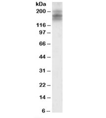 Western blot testing of human cerebellum lysate with DSCAM antibody at 2ug/ml. Predicted molecular weight: ~174 kDa.