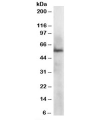 Western blot testing of HepG2 lysate with ERp57 antibody at 1ug/ml. Predicted molecular weight: ~57-60 kDa.
