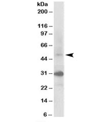 Western blot testing of human kidney lysate with FBXW2 antibody at 0.3ug/ml. Predicted molecular weight: ~51kDa. Both observed bands were blocked by addition of the immunzing peptide.