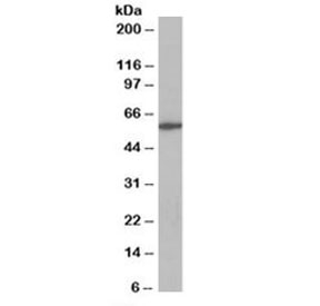 Western blot testing of Jurkat lysate with CORO1A antibody at 0.3ug/ml. Predicted molecular weight: ~51 kDa, observed here at ~60 kDa.