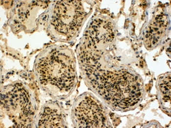 IHC testing of FFPE human testis with UBR5 antibody at 4ug/ml. HIER: steamed with pH9 Tris/EDTA buffer, HRP-staining. The antigen reveal step is REQUIRED for UBR5 detection.