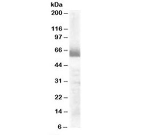 Western blot testing of human ovay lysate with CYP17A1 antibody at 0.3ug/ml. Predicted molecular weight: ~57kDa.