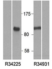 Western blot of HEK293 lysate overexpressing human HIC1 and tested with HIC1 antibody at 0.5ug/ml (right lane is mock transfection).