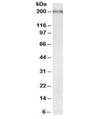 Western blot testing of fetal mouse brain lysate with Robo1 antibody at 0.05ug/ml. Predicted molecular weight (mouse): ~176kDa but may be observed at higher molecular weights due to glycosylation.