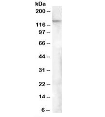 Western blot testing of human adipose lysate with FAM62A antibody at 0.5ug/ml. Predicted molecular weight: ~123 kDa, observed here at ~150 kDa.