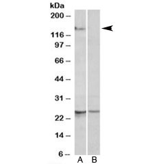 Western blot testing of mouse heart lysate with RBM20 antibody at 1ug/ml with [B] and without [A] blocking/immunizing peptide. Predicted molecular weight (mouse): ~130kDa, observed here at ~150kDa.