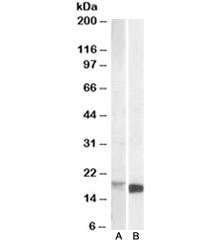 Western blot testing of mouse kidney lysate [A] and of mouse spleen lysate [B] with Pbr antibody at 1ug/ml. Predicted molecular weight: ~19 kDa.
