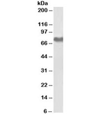 Western blot testing of human platelet lysate with Fibrinogen antibody at 0.01ug/ml. Predicted molecular weight ~70 kDa (alpha isoform), ~95 kDa (alpha-E isoform).