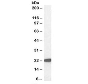 Western blot testing of human liver lysate with GPX antibody at 1ug/ml. Predicted molecular weight ~22 kDa.