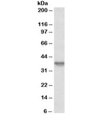 Western blot testing of HepG2 lysate with Syndecan 1 antibody at 1ug/ml. Expected molecular weight: 32-95 kDa depending on glycosylation level.