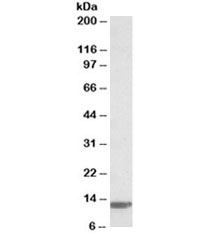 Western blot testing of human duodenum lysate with B2M antibody at 0.03ug/ml. Predicted molecular weight ~14 kDa.