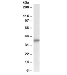 Western blot testing of human heart lysate with delta-Sarcoglycan antibody at 0.1ug/ml. Predicted molecular weight: ~35kDa.