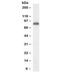 Western blot testing of human pancreas lysate with biotinylated TRPV5 antibody at 1ug/ml. Predicted/observed molecular weight: ~85kDa.