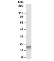 Western blot testing of K562 lysate with p18 antibody at 0.1ug/ml. Predicted molecular weight: ~20kDa, routinely observed at 18~20kDa.