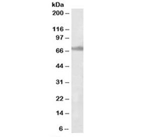 Western blot testing of rat ovay lysate with ENC1 antibody at 1ug/ml. Predicted molecular weight: ~66 kDa.