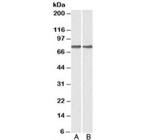 Western blot testing of A) HepG2 and B) MCF7 cell lysate with GRP78 antibody at 0.1ug/ml. Predicted molecular weight: ~73 kDa, but routinely observed at 70-78 kDa.