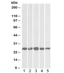 Western blot testing of 1) mouse NIH3T3 and human 2) HeLa, 3) K562, 4) MCF7 and 5) HepG2 lysates with Casein kinase 2 beta antibody at 1ug/ml. Predicted molecular weight: ~25kDa.