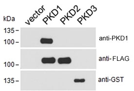PKD1-FLAG, PKD2-FLAG and PKD3-GST transfected HEK293 cell lysate probed with GST, FLAG or PKD1 antibody at 0.1ug/ml. Expected molecular weight ~102 kDa. Data courtesy of Dr Peter Storz, Mayo Clinic, USA.