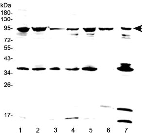 Western blot testing of human 1) HeLa, 2) 293T, 3) SKOV3, 4) A549, 5) MCF7, 6) placenta and 7) PANC-1 lysate with FES antibody at 0.5ug/ml. Predicted molecular weight ~93 kDa.
