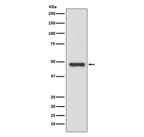 Western blot testing of human LNCaP cell lysate with uPA antibody. Predicted molecular weight ~48 kDa.