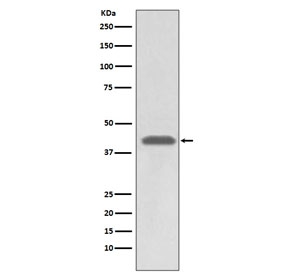 Western blot testing of human A549 cell lysate with HLA-A antibody. Predicted molecular weight ~41 kDa.