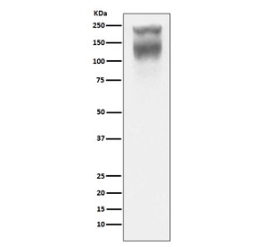 Western blot testing of human colon cancer lysate with CEA antibody. Expected molecular weight: 80~200 kDa depending on glycosylation level.