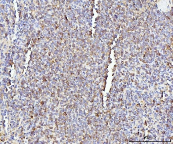 IHC staining of FFPE rat spleen tissue with Il-17a antibody. HIER: boil tissue sections in pH8 EDTA for 20 min and allow to cool before testing.