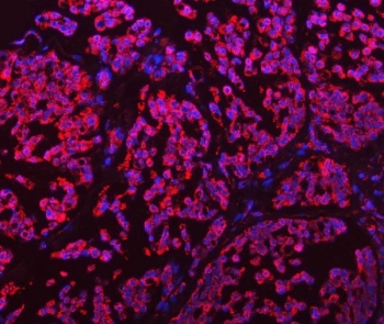 GLUD1/2 Antibody | RQ7175 NSJ Bioreagents