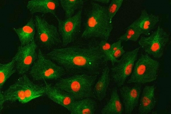 Immunofluorescent staining of FFPE human A549 cells with SNF2H antibody (red) and Beta Tubulin mAb (green). HIER: steam section in pH6 citrate buffer for 20 min.