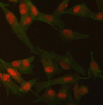 Immunofluorescent staining of FFPE human U-87 MG cells with SMCHD1 antibody (red) and Beta Tubulin mAb (green). HIER: steam section in pH6 citrate buffer for 20 min.