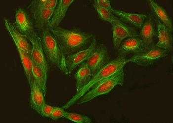 Immunofluorescent staining of FFPE human U-2 OS cells with Regulatory factor X 3 antibody (red) and Alpha Tubulin mAb (green). HIER: steam section in pH6 citrate buffer for 20 min.