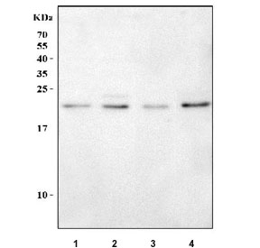 Western blot testing of 1) human U-87 MG, 2) human HEL, 3) rat L6 and 4) mouse C2C12 cell lysate with RAB7A antibody. Predicted molecular weight ~23 kDa.