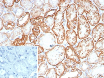 IHC staining of FFPE human kidney tissue with Cadherin 16 antibody (clone CDH16/2449). HIER: boil tissue sections in pH 9 10mM Tris with 1mM EDTA for 20 min and allow to cool before testing.