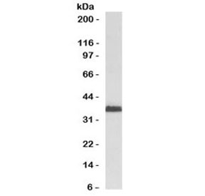 Western blot testing of human HeLa cell lysate with RAD51 antibody (clone RALPA-1). Expected molecular weight ~37 kDa.