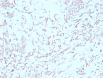 IHC staining of FFPE human liver tissue with Kindlin 2 antibody (clone 3A3). HIER: boil tissue sections in pH 9 10mM Tris with 1mM EDTA for 20 min and allow to cool before testing.